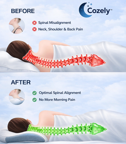 Cozely– Soporte óptimo para quienes duermen de lado